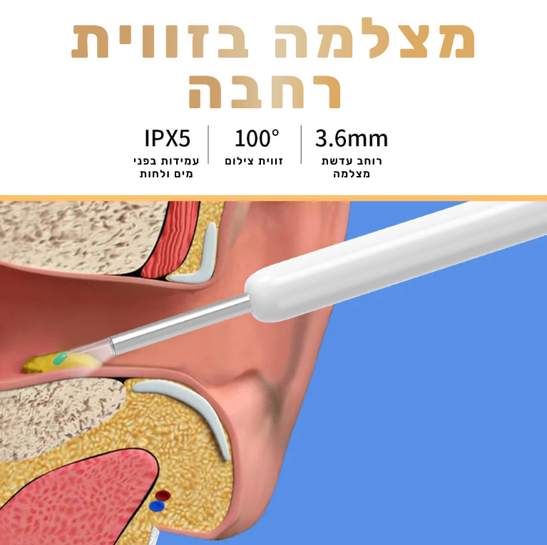 מנקה אוזניים חכם עם מצלמה - Otocare