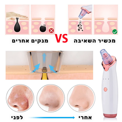 מכשיר להסרת ראשים שחורים